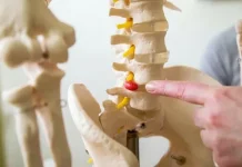 Чем лечить межпозвоночную грыжу: современные подходы и советы