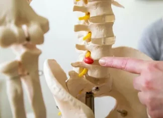 Чем лечить межпозвоночную грыжу: современные подходы и советы